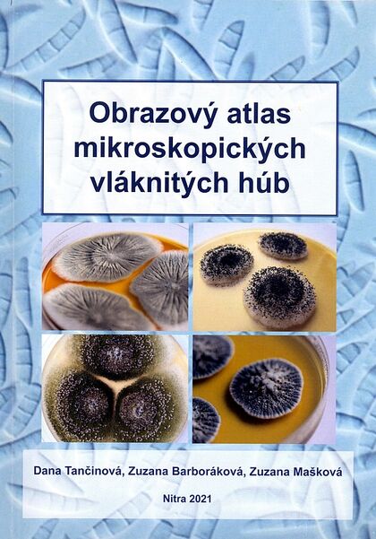 Obrazový atlas mikroskopických húb