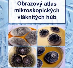 Obrazový atlas mikroskopických húb